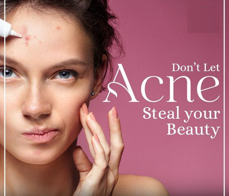 ACNE SCARS REDUCTION THERAPY