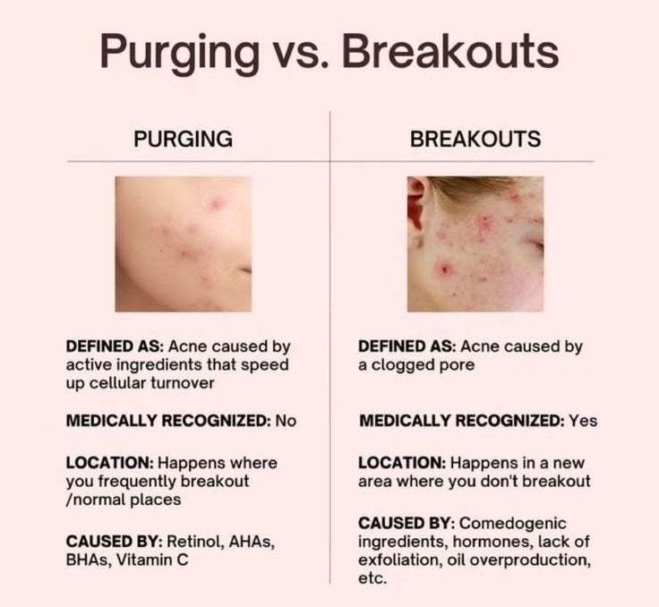 ACNE SCARS REDUCTION THERAPY