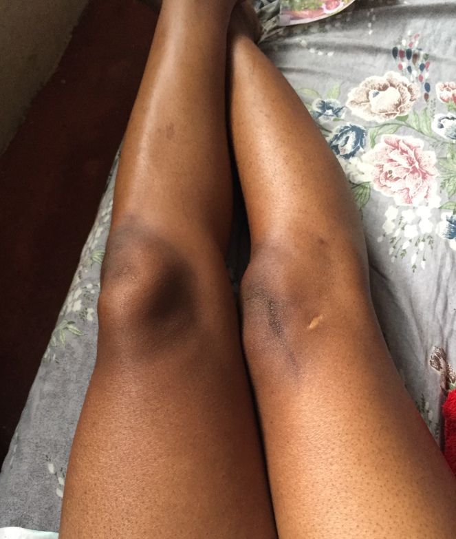 ANY BODY PARTS EXFOLIATION ( PEELING )