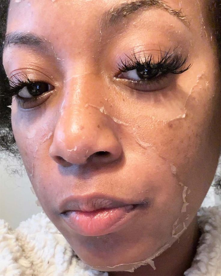 ANY BODY PARTS EXFOLIATION ( PEELING )