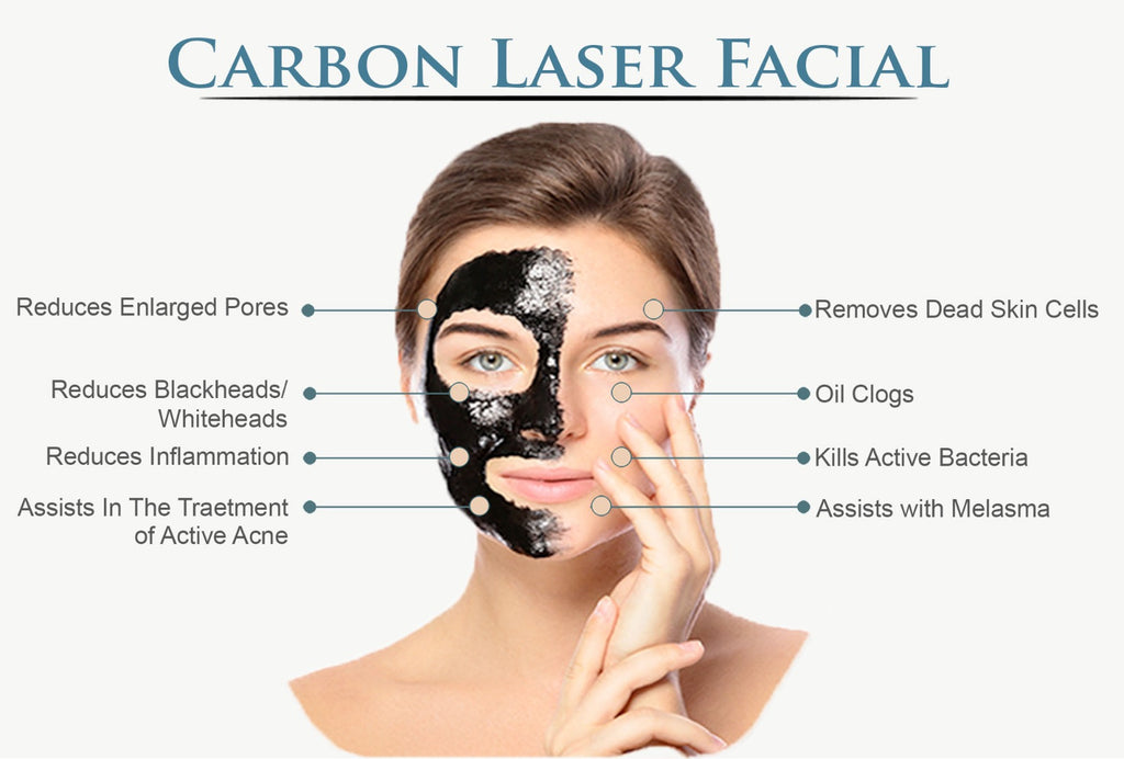 CARBON LASER FACIAL