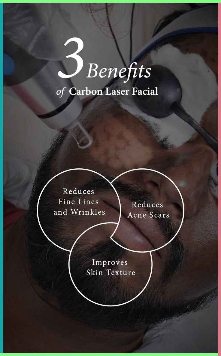 CARBON LASER FACIAL