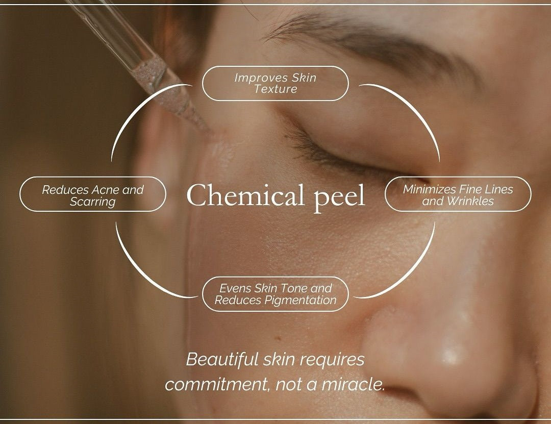CHEMICAL PEELS THERAPY