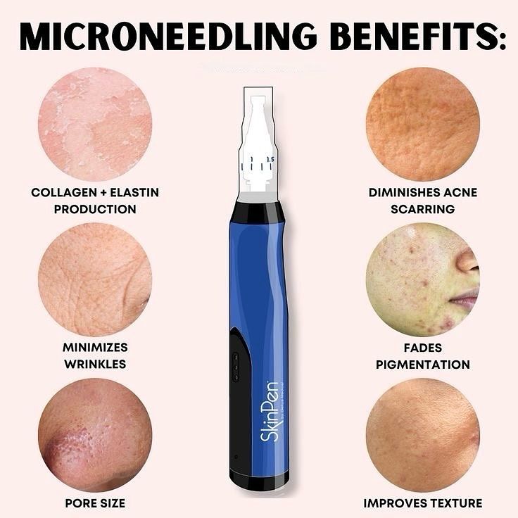 DERMAPEN MICRONEEDLING THERAPY