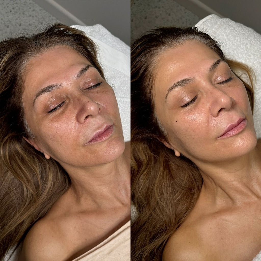 FACE FIRMING FACIAL THERAPY