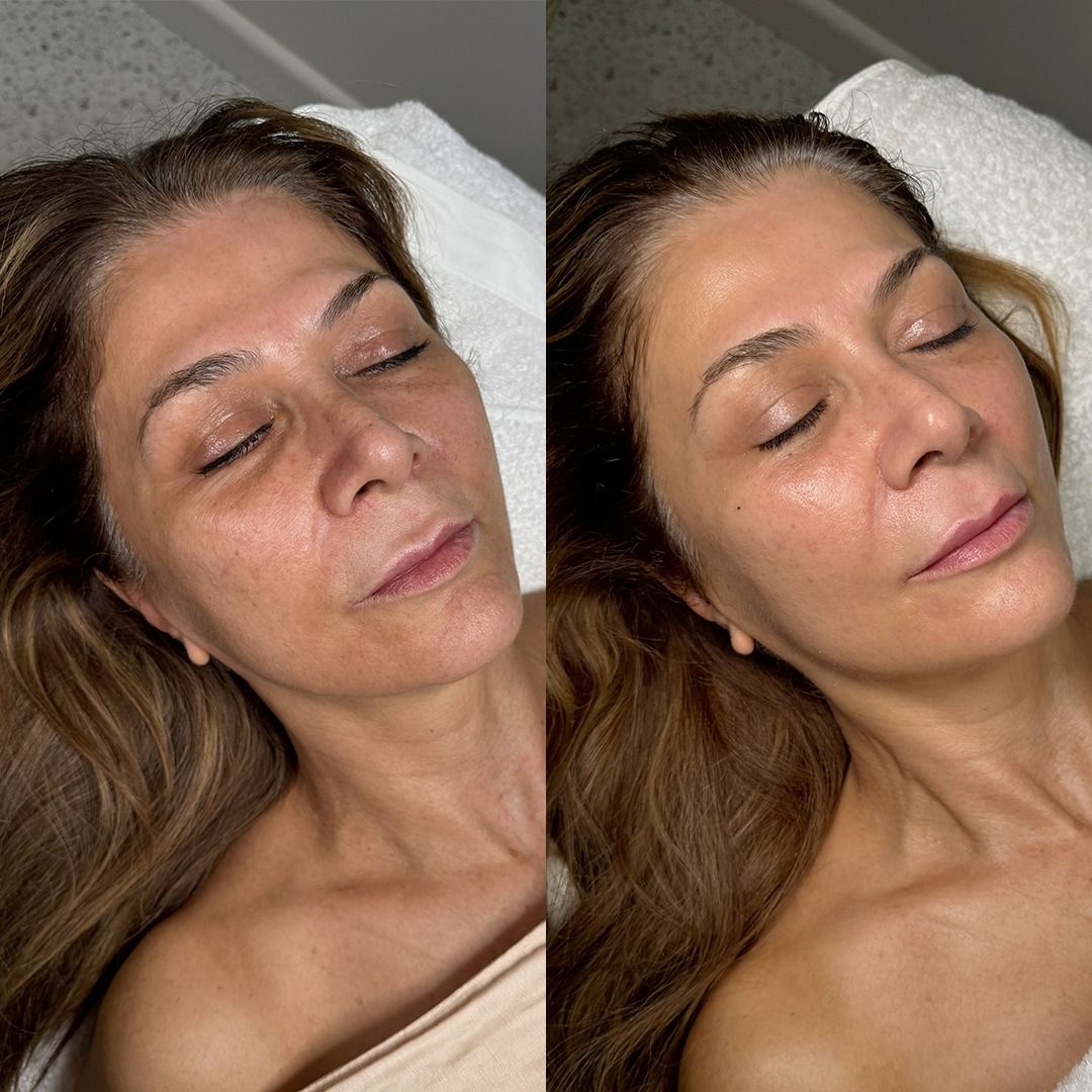 FACE FIRMING FACIAL THERAPY