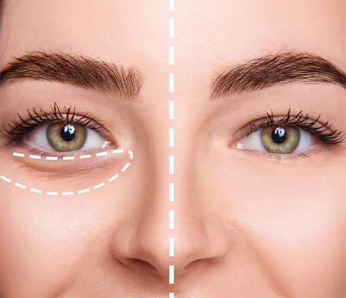 FOCUSED EYELID AND UNDER EYE CARE