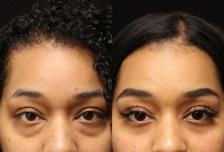 FOCUSED EYELID AND UNDER EYE CARE