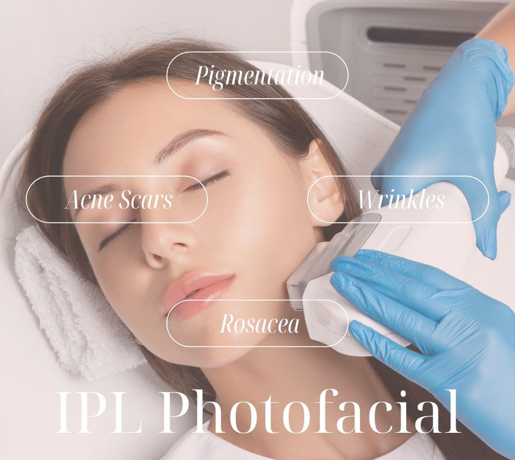 INTENSE PULSE LIGHT (IPL) SKIN REJUVENATION