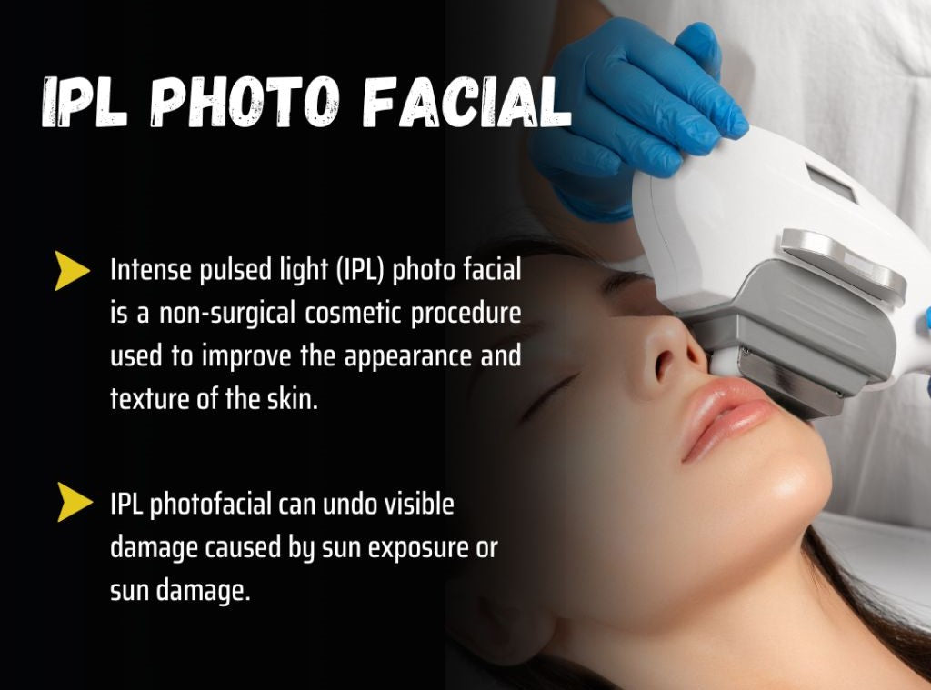 INTENSE PULSE LIGHT (IPL) SKIN REJUVENATION