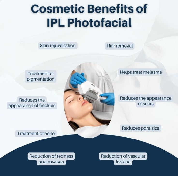 INTENSE PULSE LIGHT (IPL) SKIN REJUVENATION