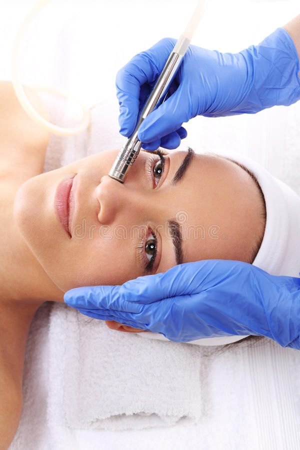 MICRODERMABRASION (MDA) THERAPY