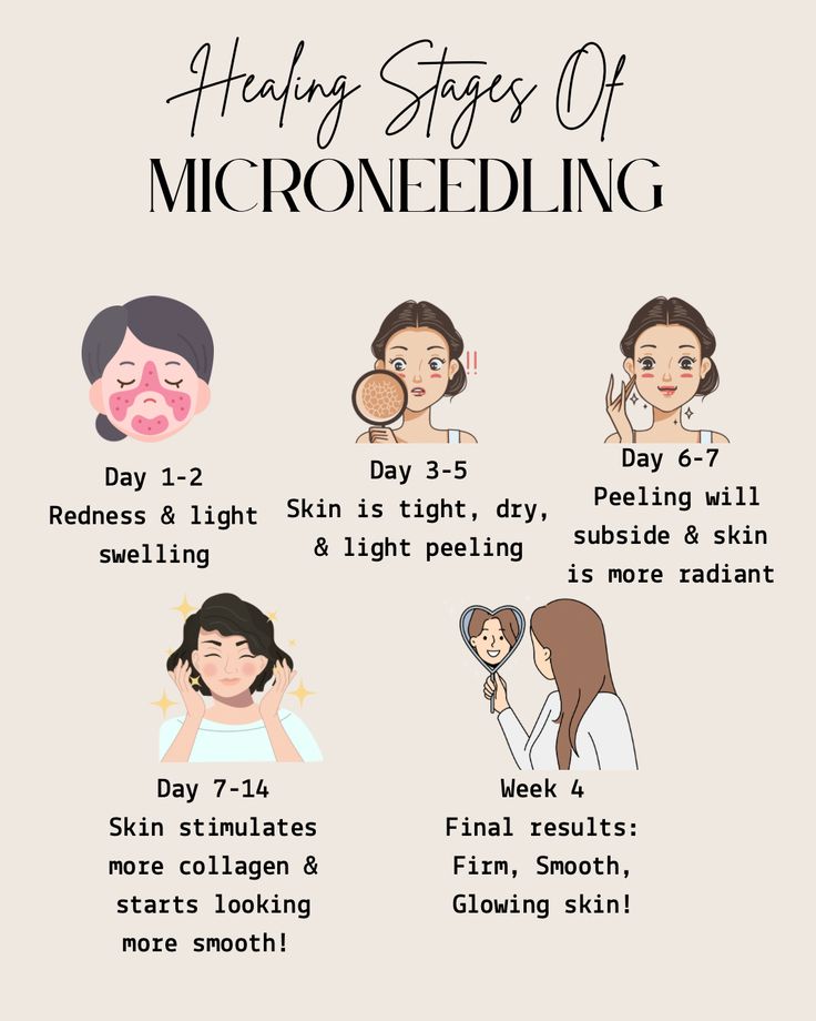 MICRONEEDLING THERAPY