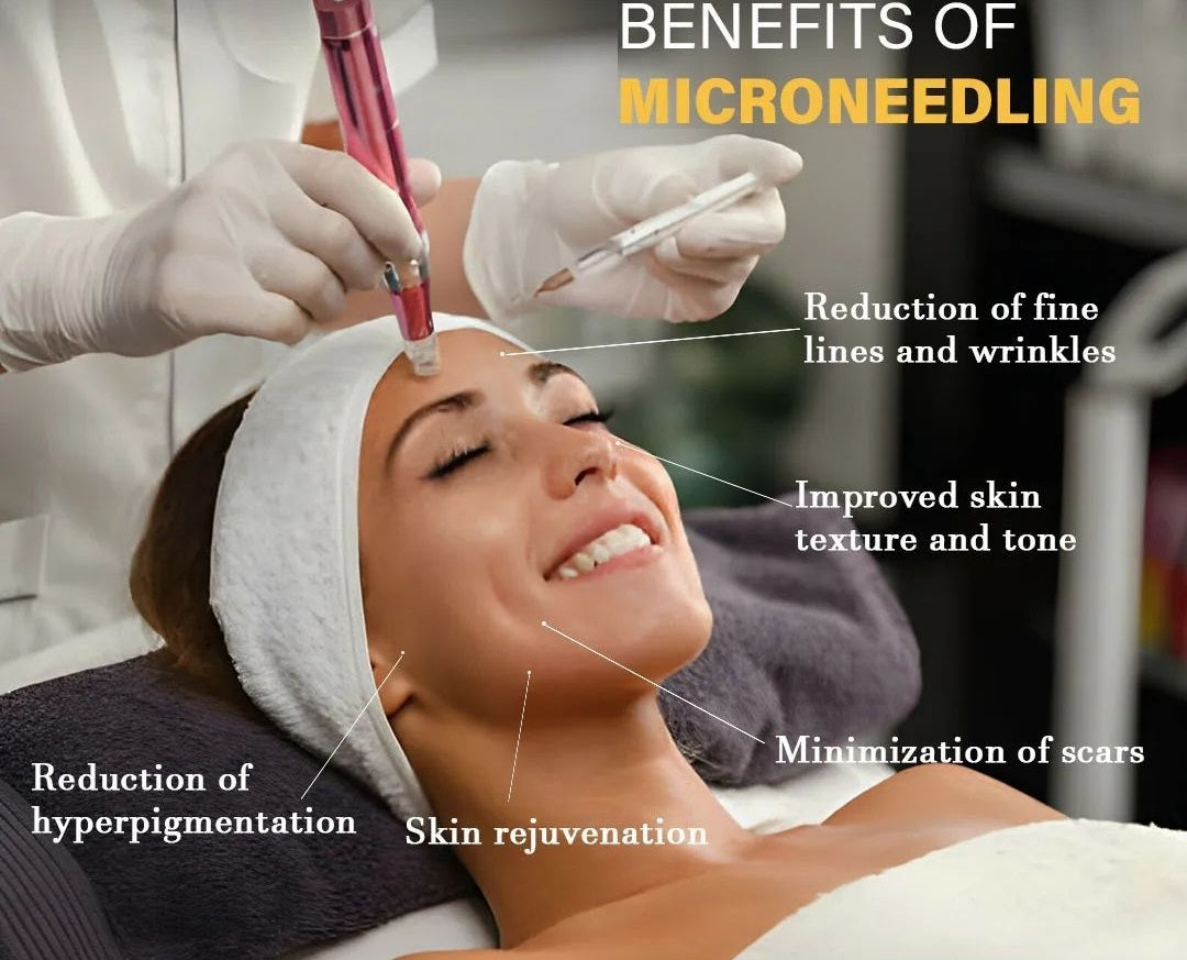 MICRONEEDLING THERAPY