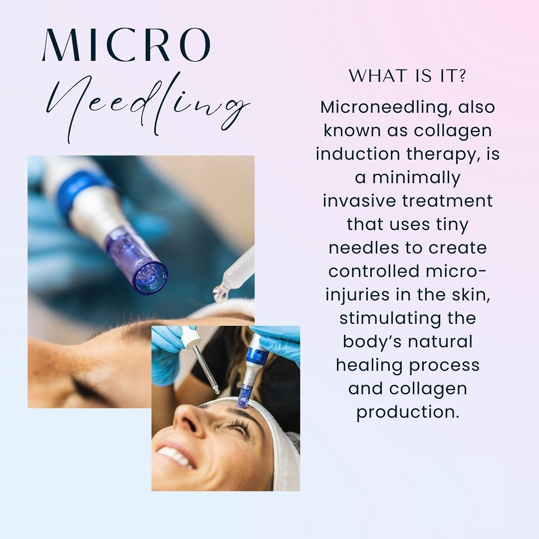 MICRONEEDLING THERAPY