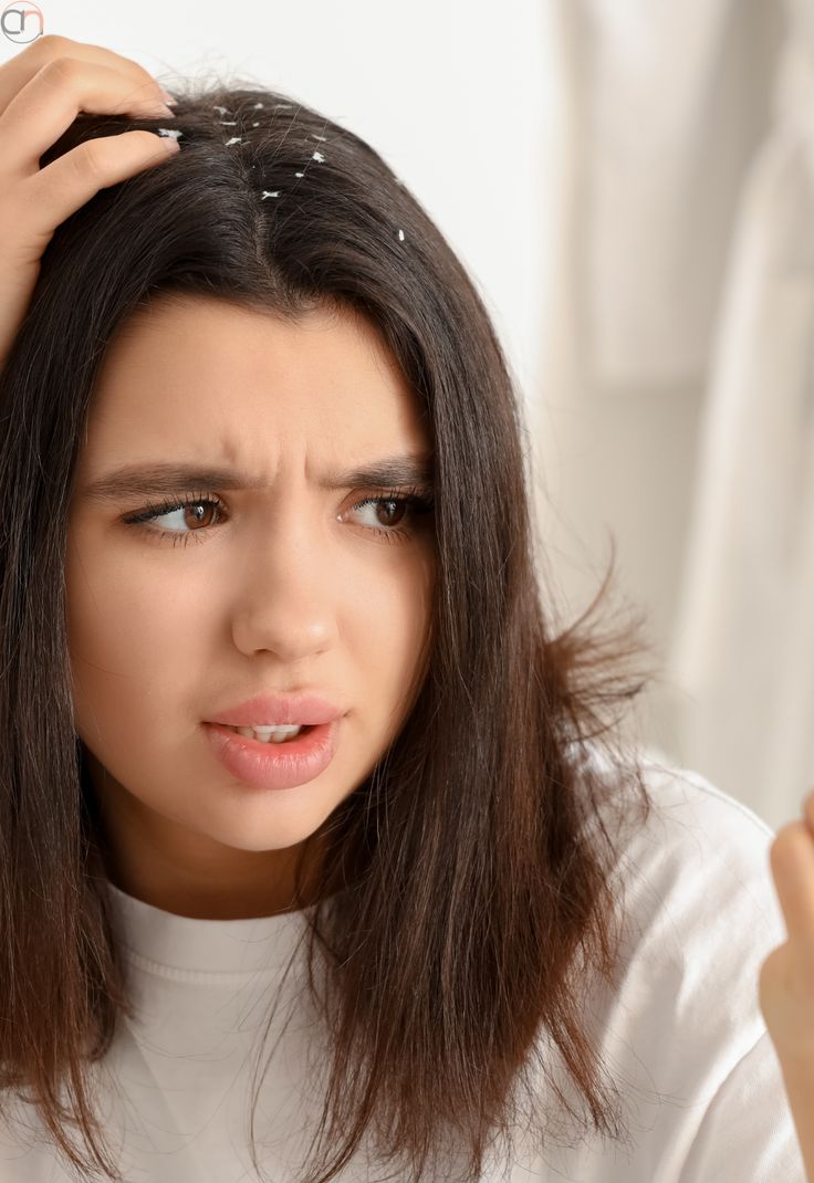 SCALPURE (dandruff removal therapy)