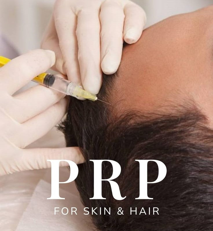 SCALP PRP THERAPY