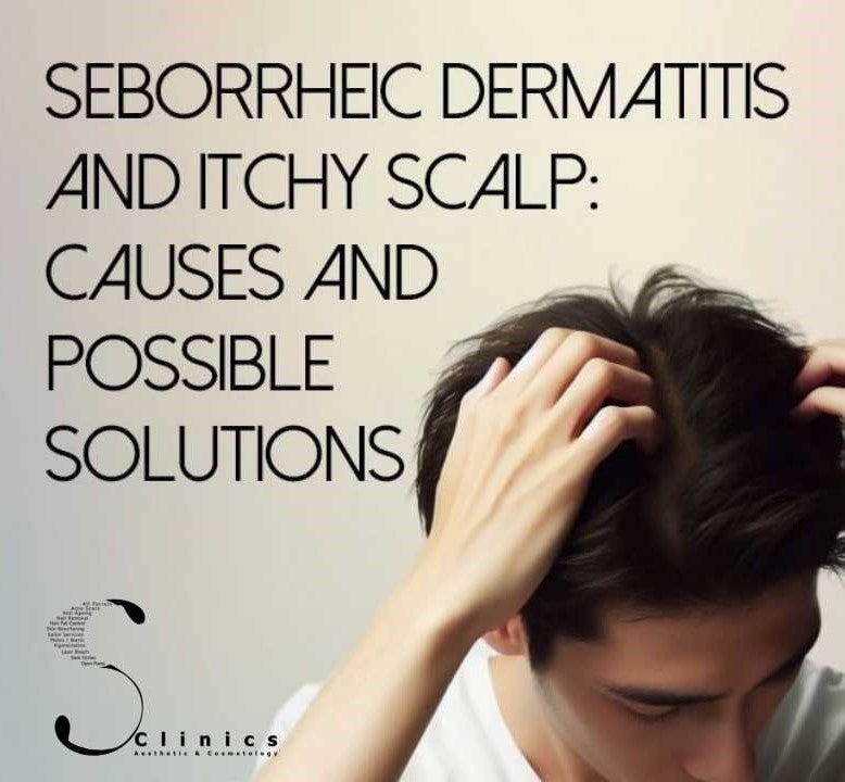 SEBORRHEIC DERMATITIS THERAPY