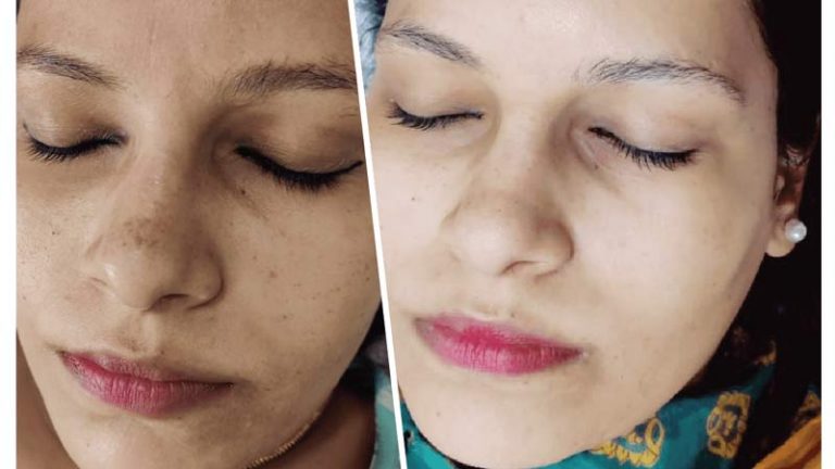 SKIN POLISHING THERAPY